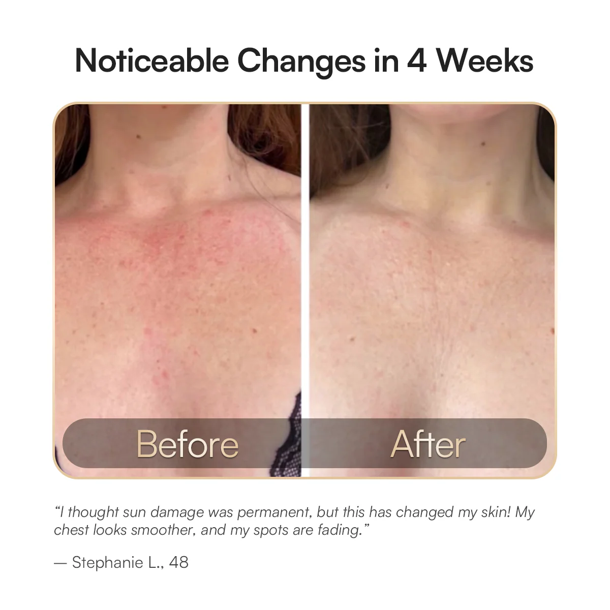 INIA Face & Neck Pro Kit - Image 11