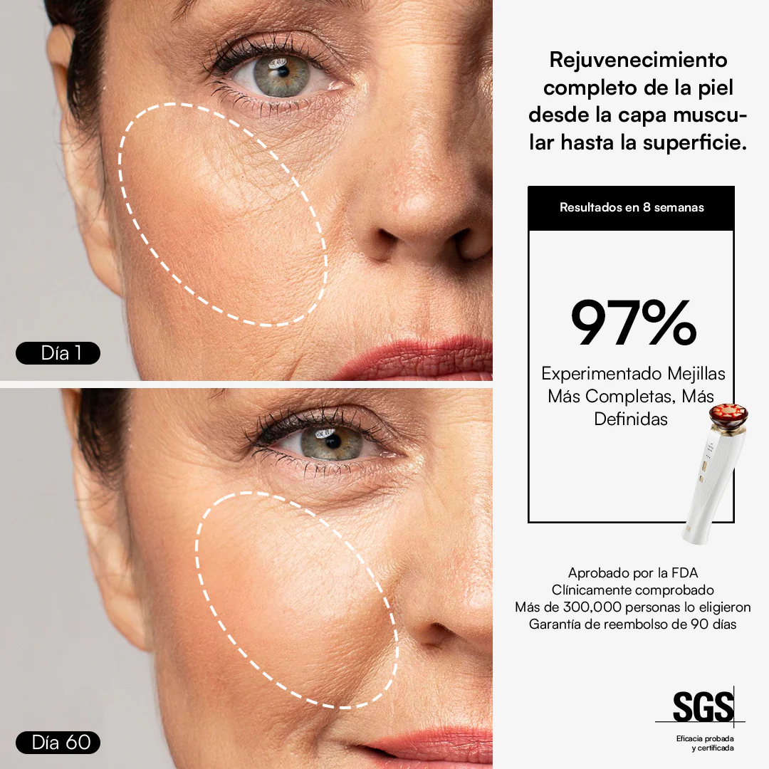 INIA FLARE Dispositivo Facial de Microcorriente - Image 7