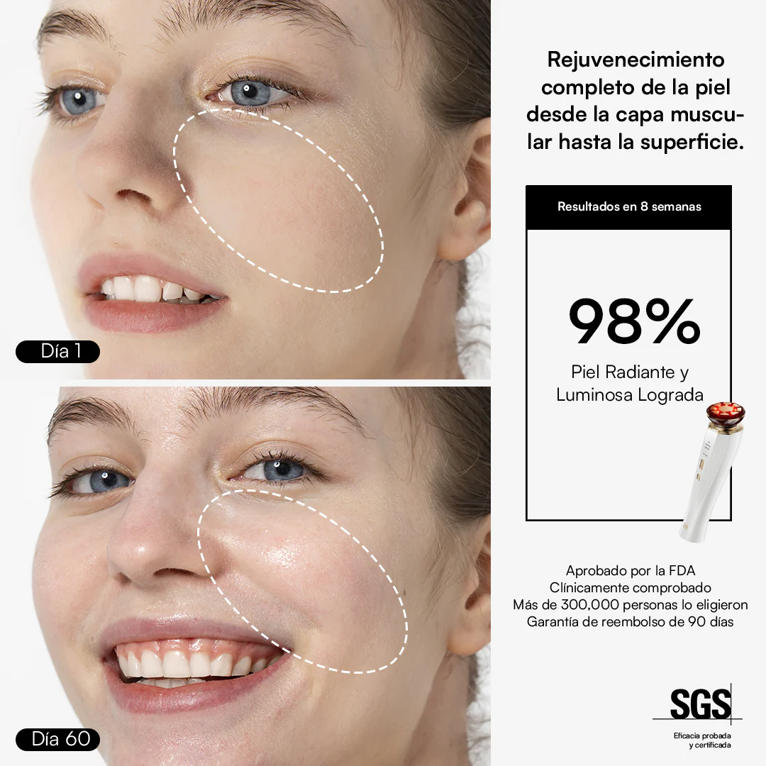 INIA FLARE Dispositivo Facial de Microcorriente - Image 8