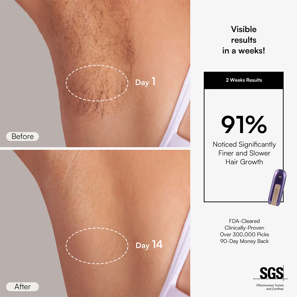 INIA FOND IPL Laser Hair Removal with Facial Mask - Image 3