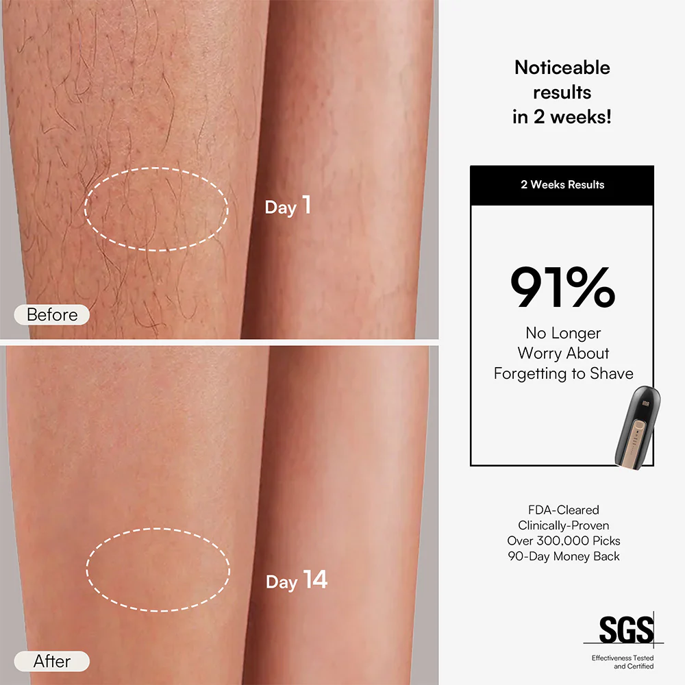 INIA FOND IPL Laser Hair Removal with Facial Mask - Image 6