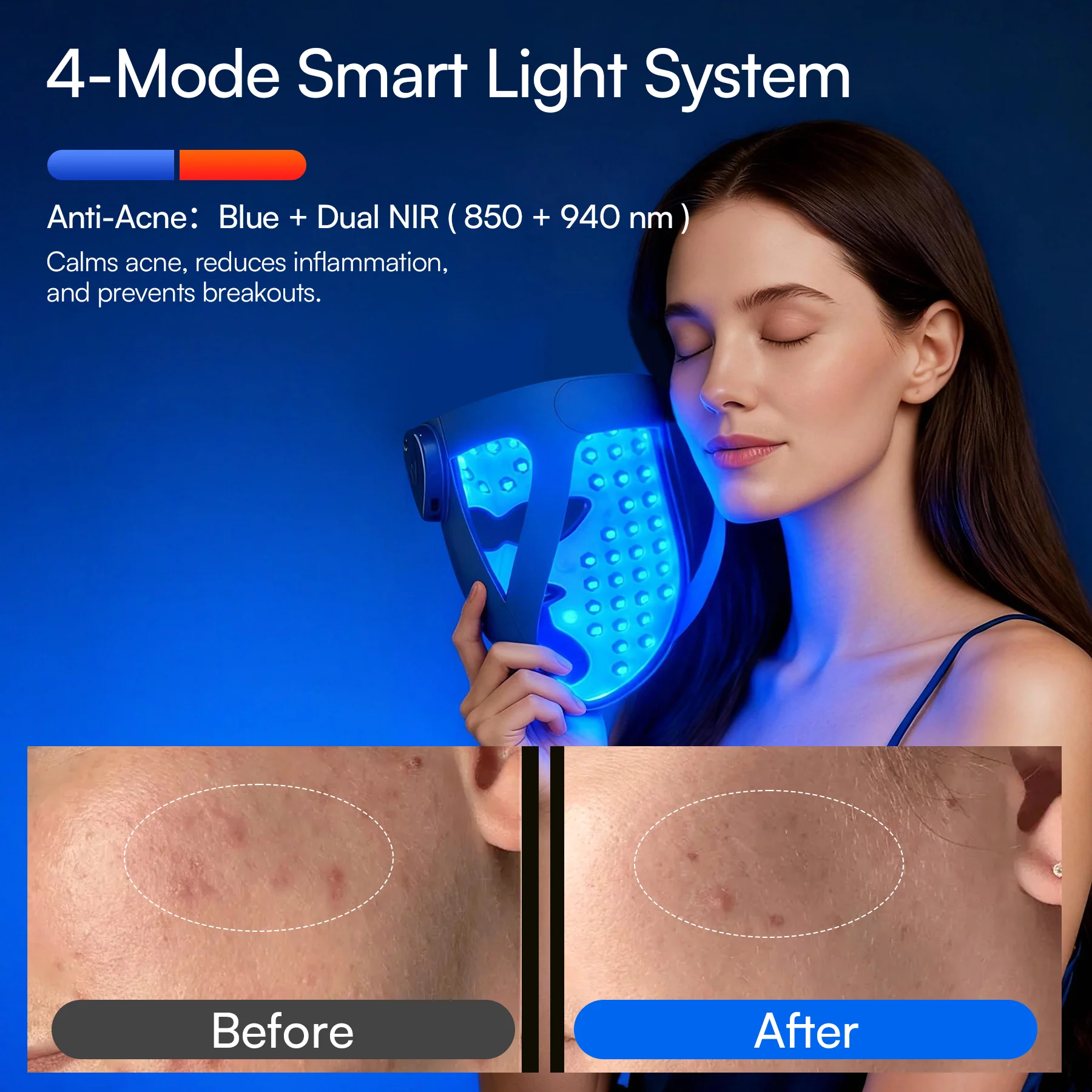 INIA GLOW 4D 940nm Dual NIR Wireless LED Mask - Image 5