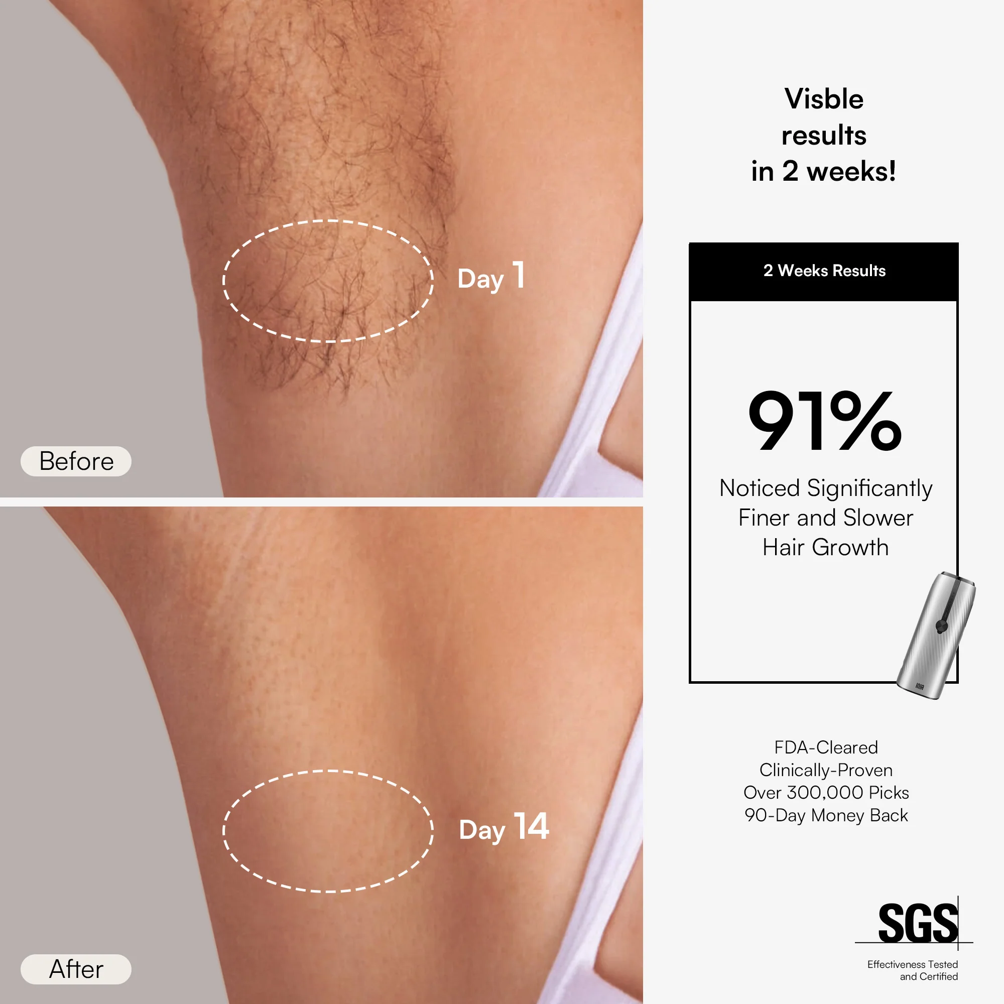 INIA HAUTE IPL Hair Removal Device - Image 3