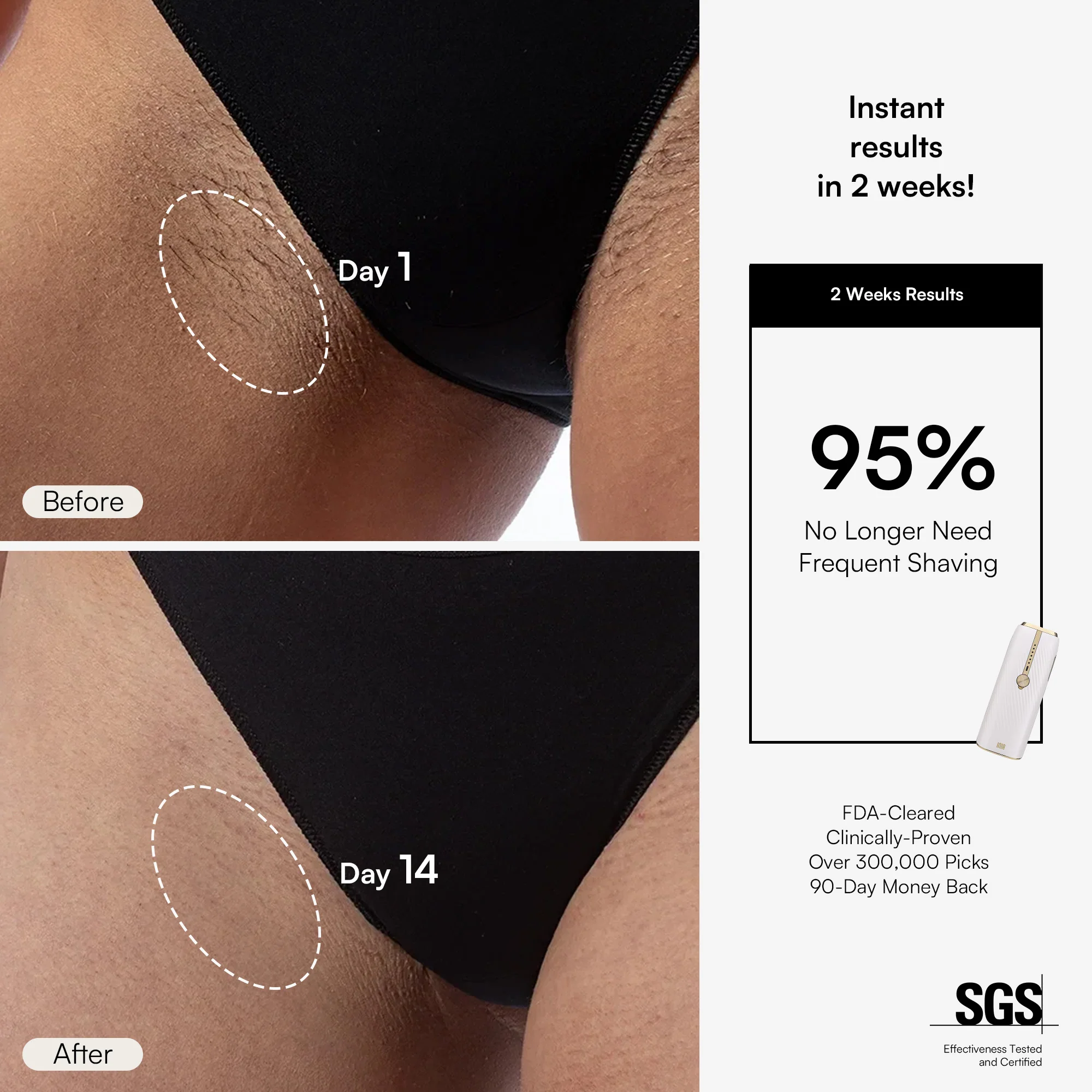 INIA HAUTE IPL Hair Removal Device - Image 4