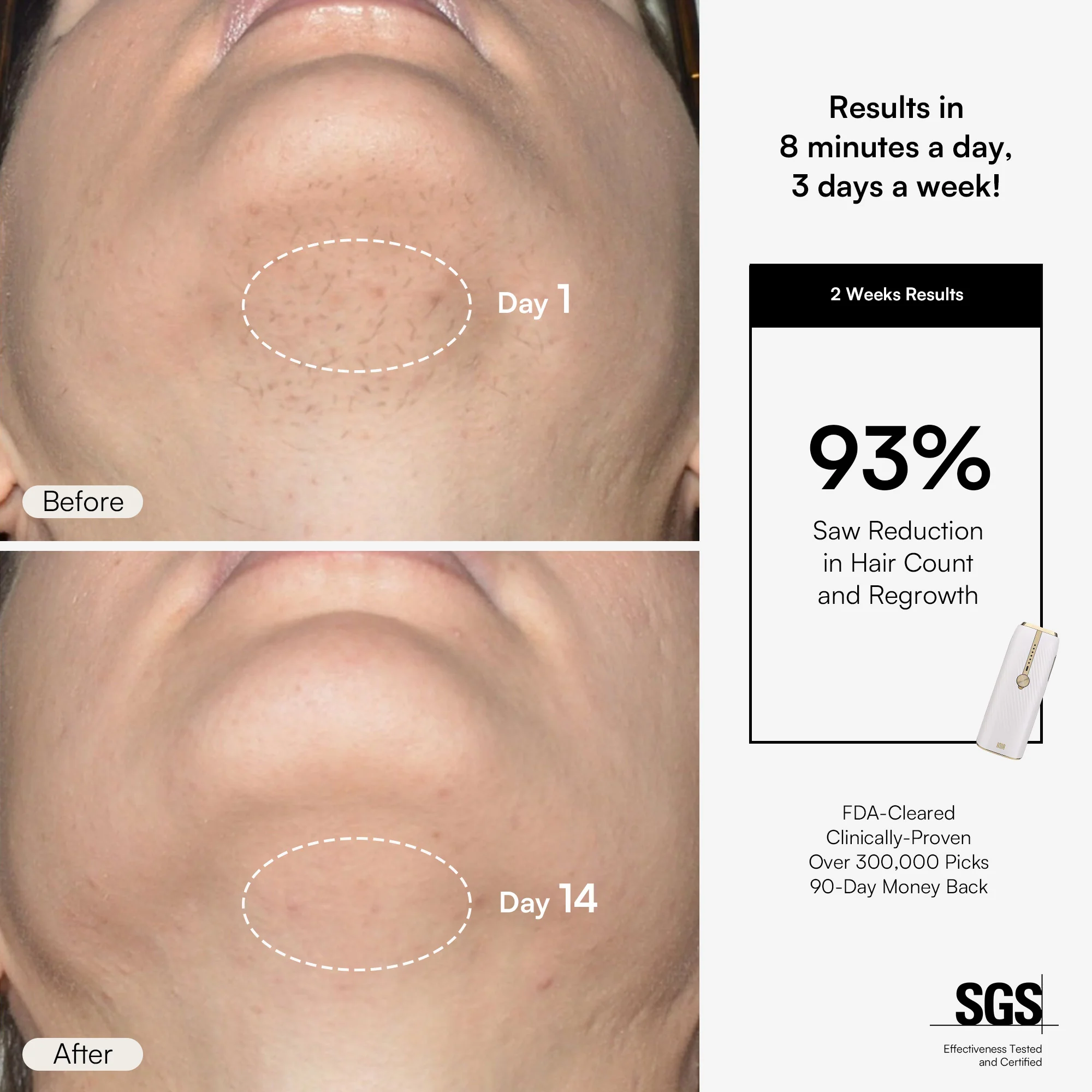 INIA HAUTE IPL Hair Removal Device - Image 6