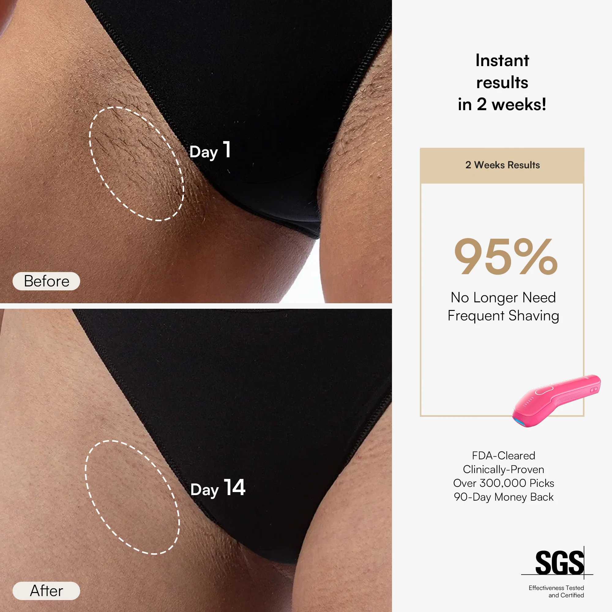 INIA HAUTE Pro IPL Laser Hair Removal Device - Image 4