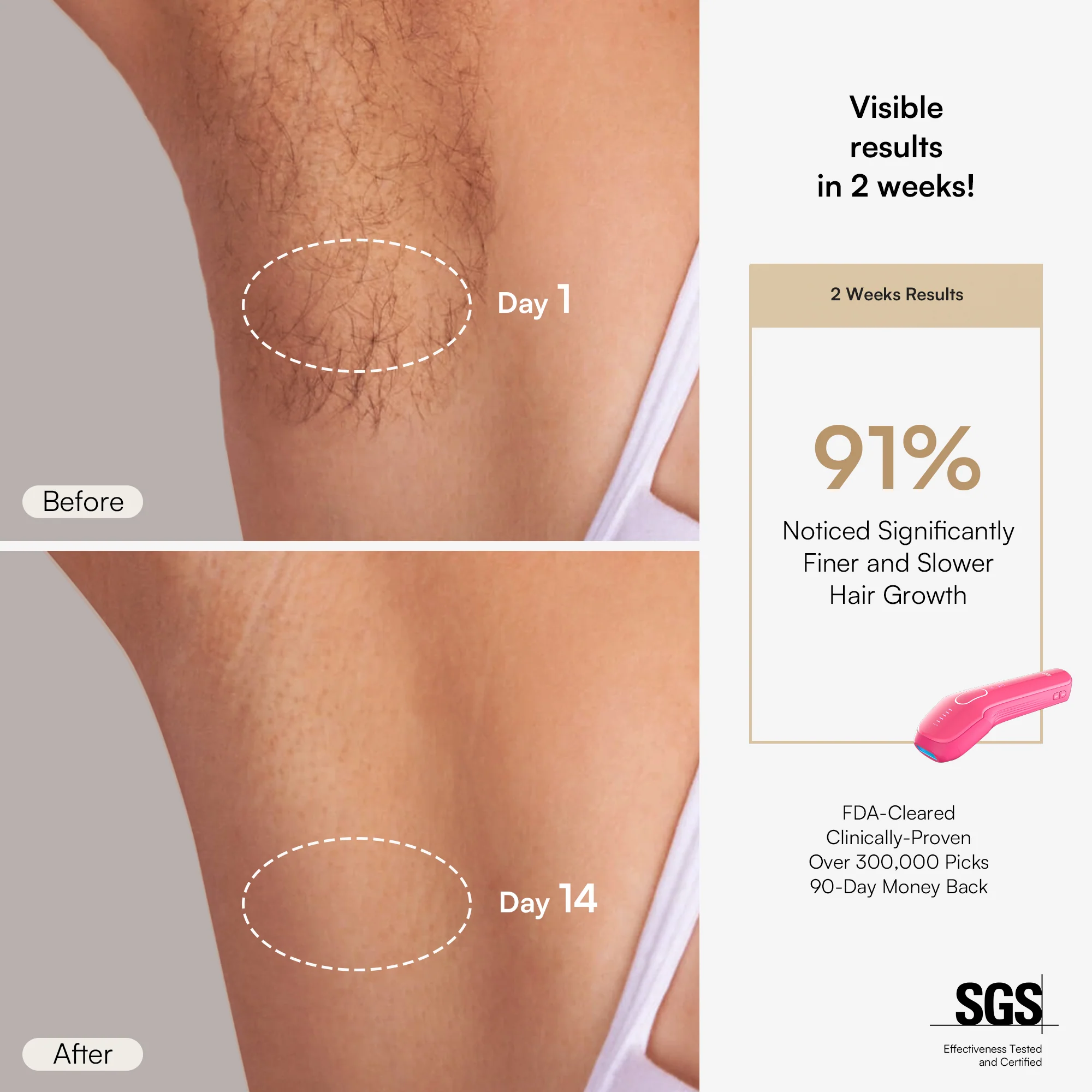 INIA HAUTE Pro IPL Laser Hair Removal Device - Image 5