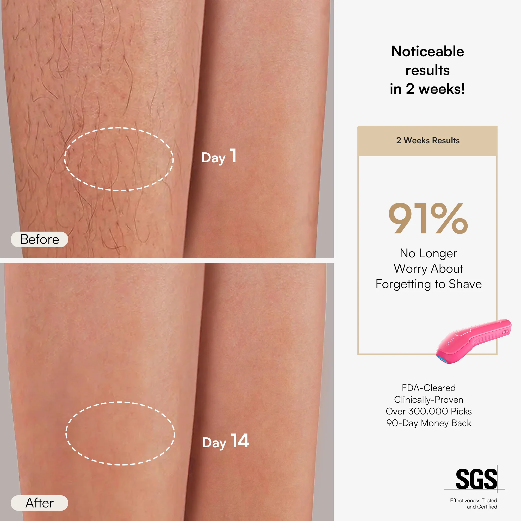 INIA HAUTE Pro IPL Laser Hair Removal Device - Image 6