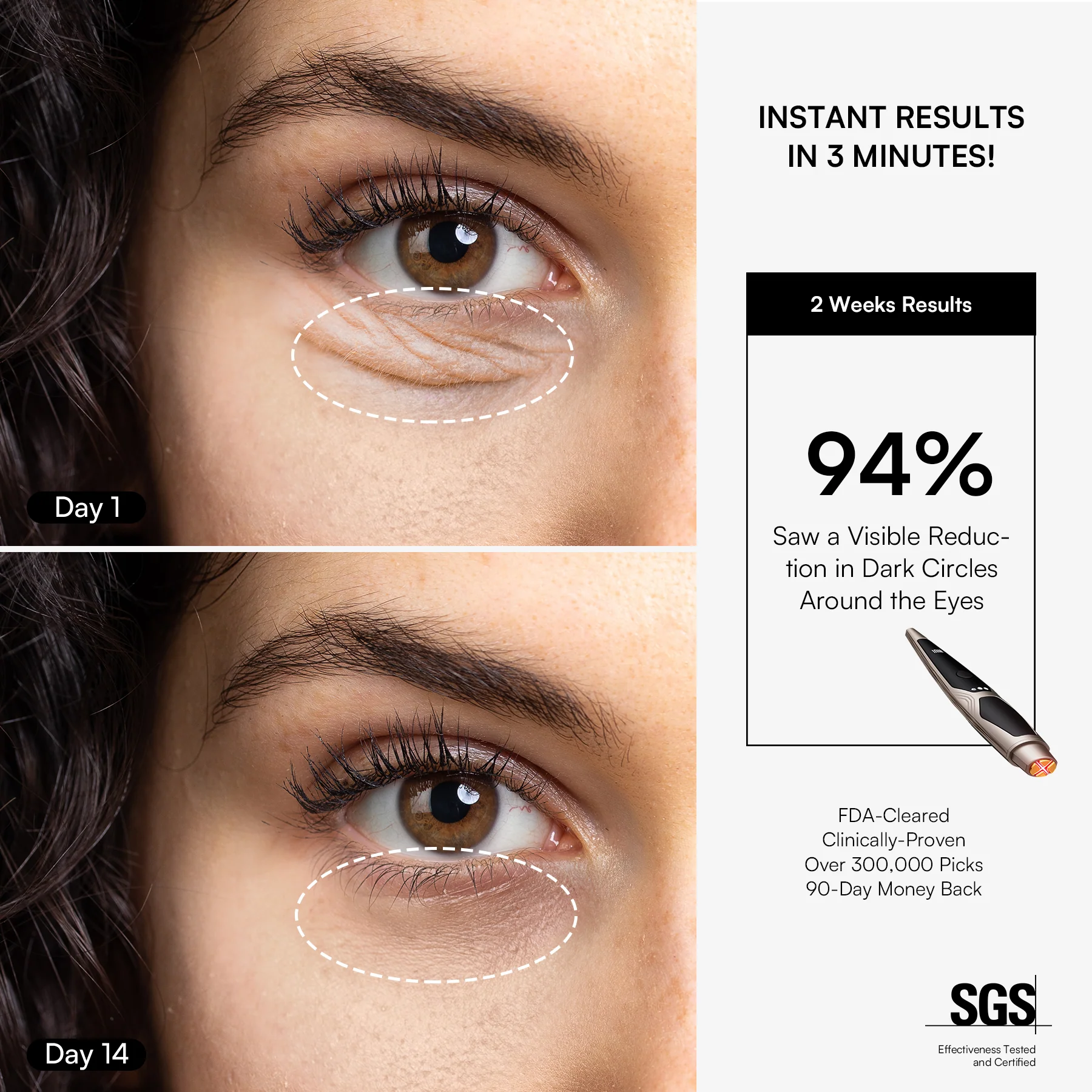 INIA LUMIN Eye Skincare Device FDA-Cleared - Image 4