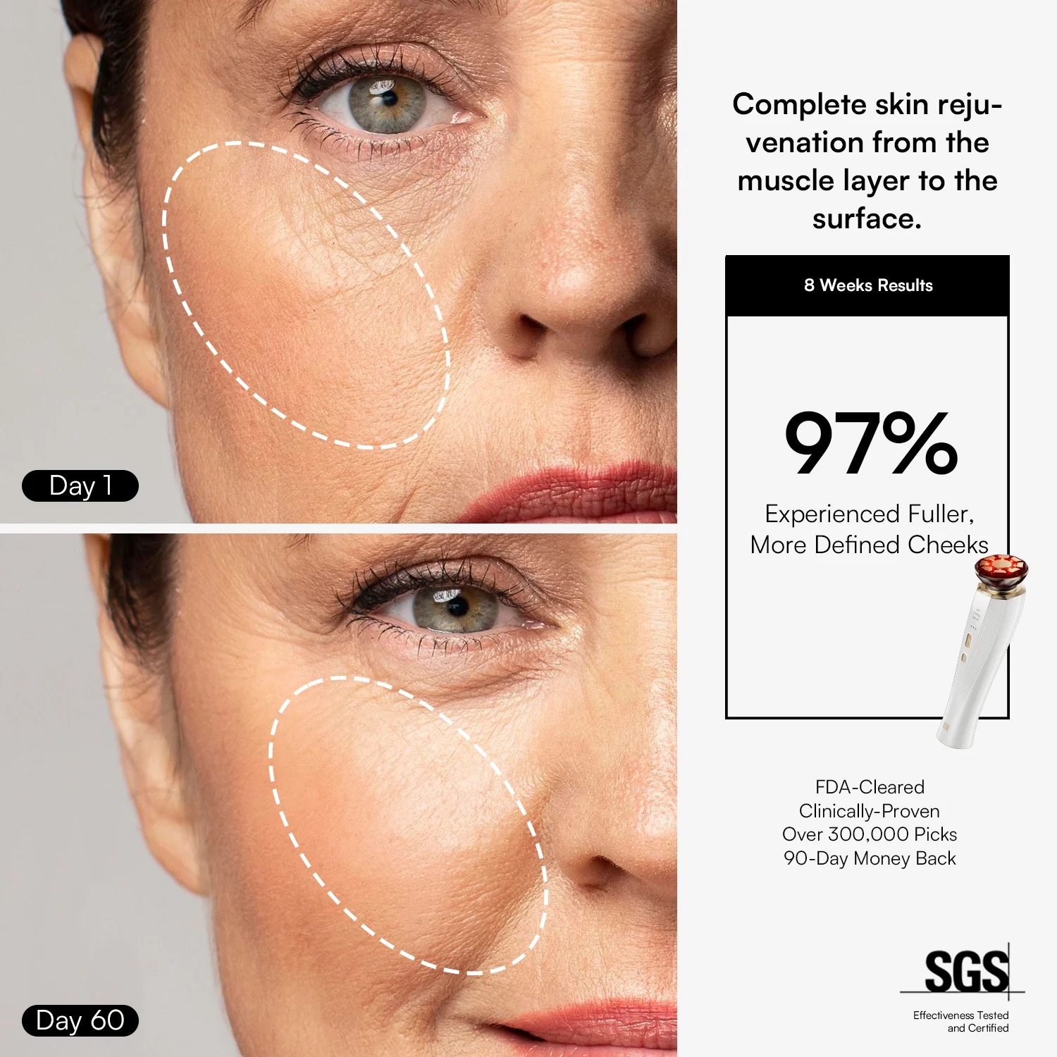 INIA PDRN Firming & Lift Kit - Image 6