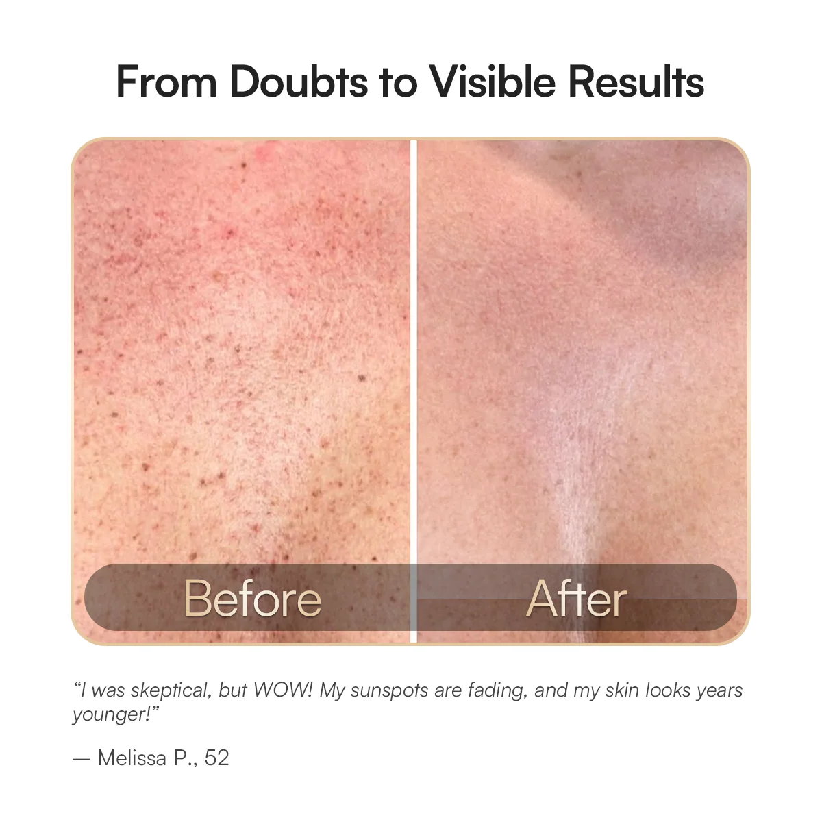 INIA Red Light Therapy Mask for Neck & Décolleté - Image 4