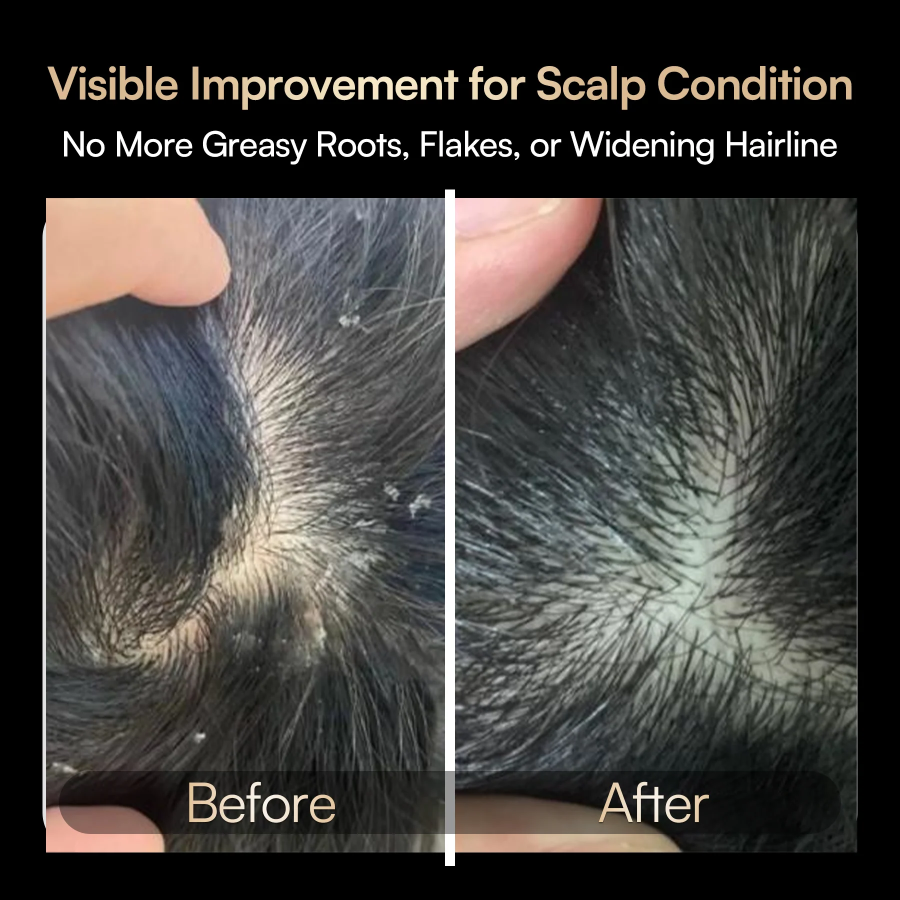 INIA VIBRA 4-in-1 Scalp Therapy Device FDA-Cleared - Image 3